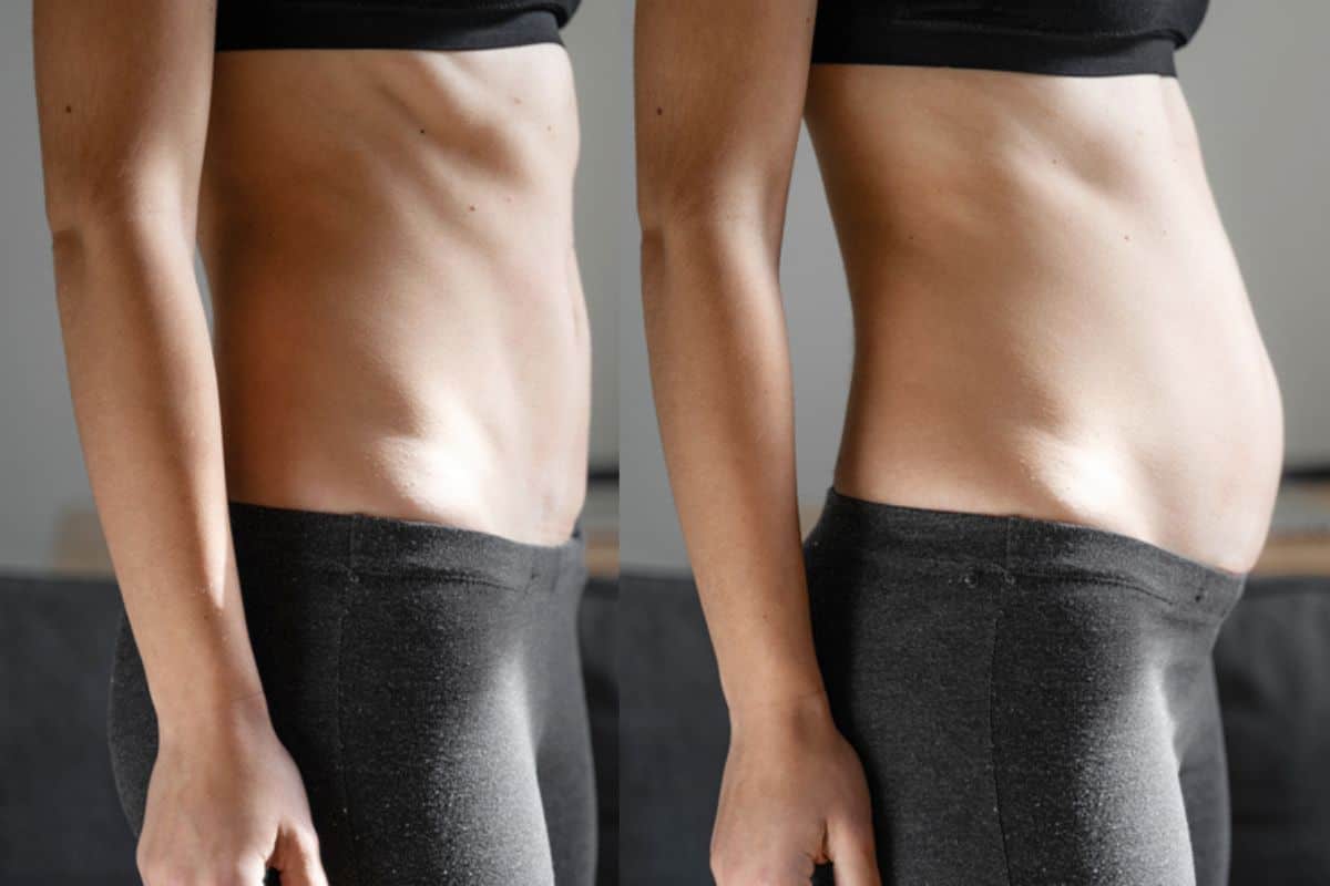 How long does diastasis recti take to improve Havant?