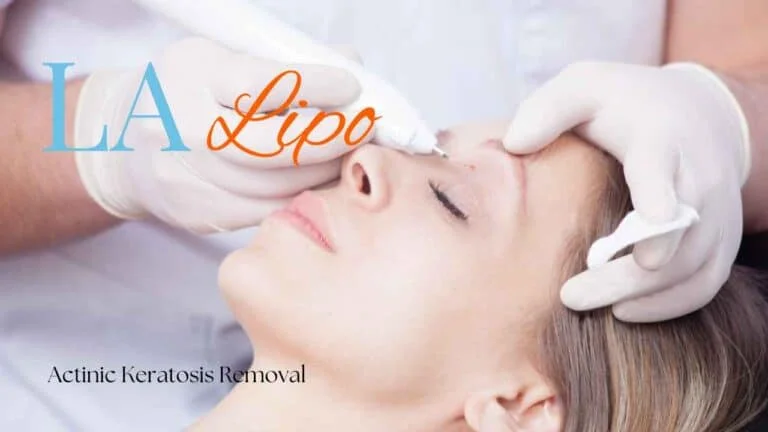 Woman receiving Actinic Keratosis Removal Treatment Havant