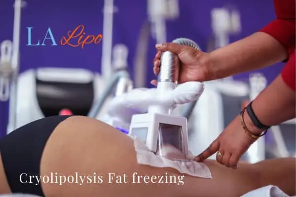 women getting fat freezing Havant