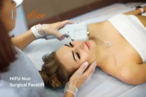 Woman having Hi-Fu to reduce wrinkles Havant.