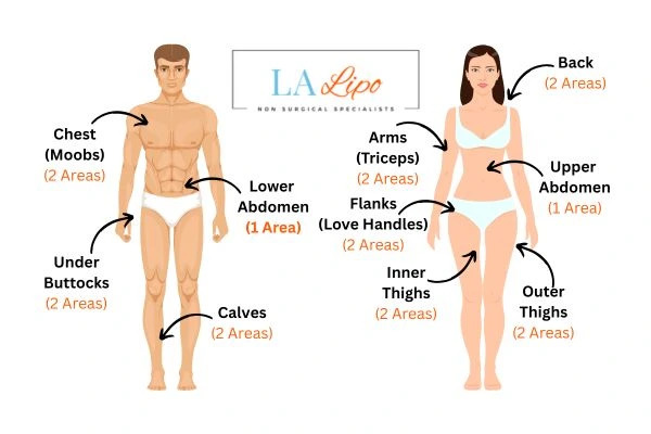 LA LIPO Cryolipolysis Areas Havant