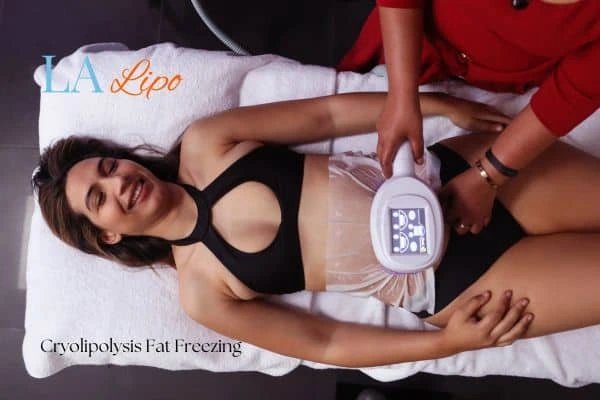 woman getting cryolipolysis Havant