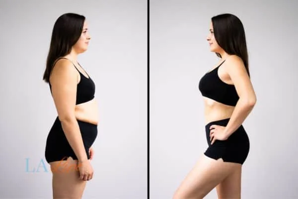 link between body image and mental health Havant