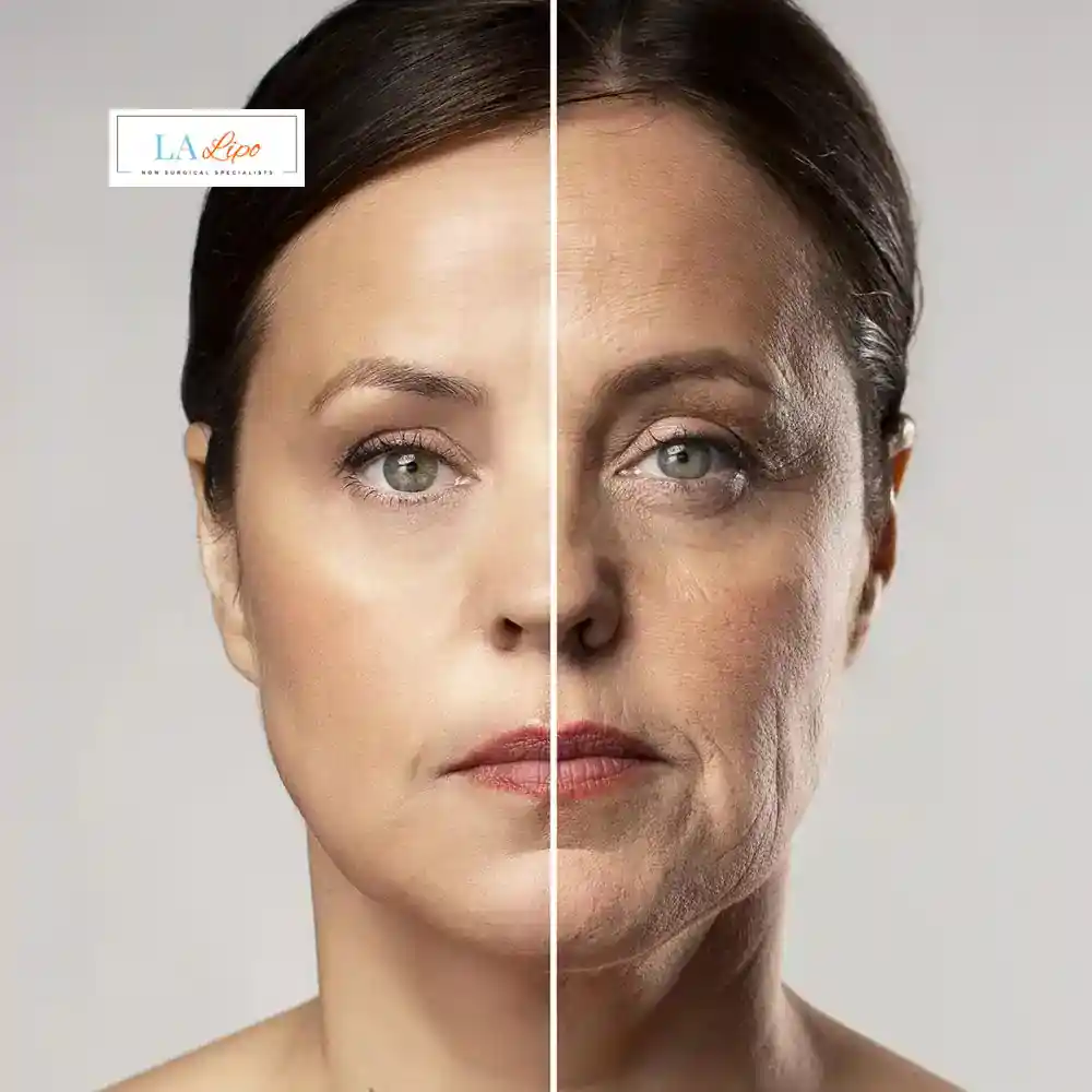 How Can You Tell If Non-Surgical Skin Tightening Is Right for You Havant?