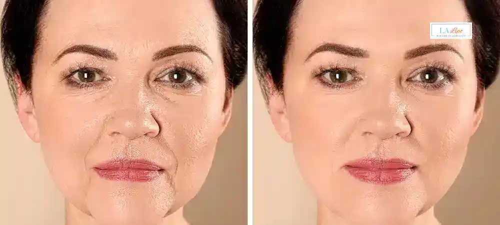 Why Aren’t My Skincare Products Making My Sagging Skin Look Firmer Havant?