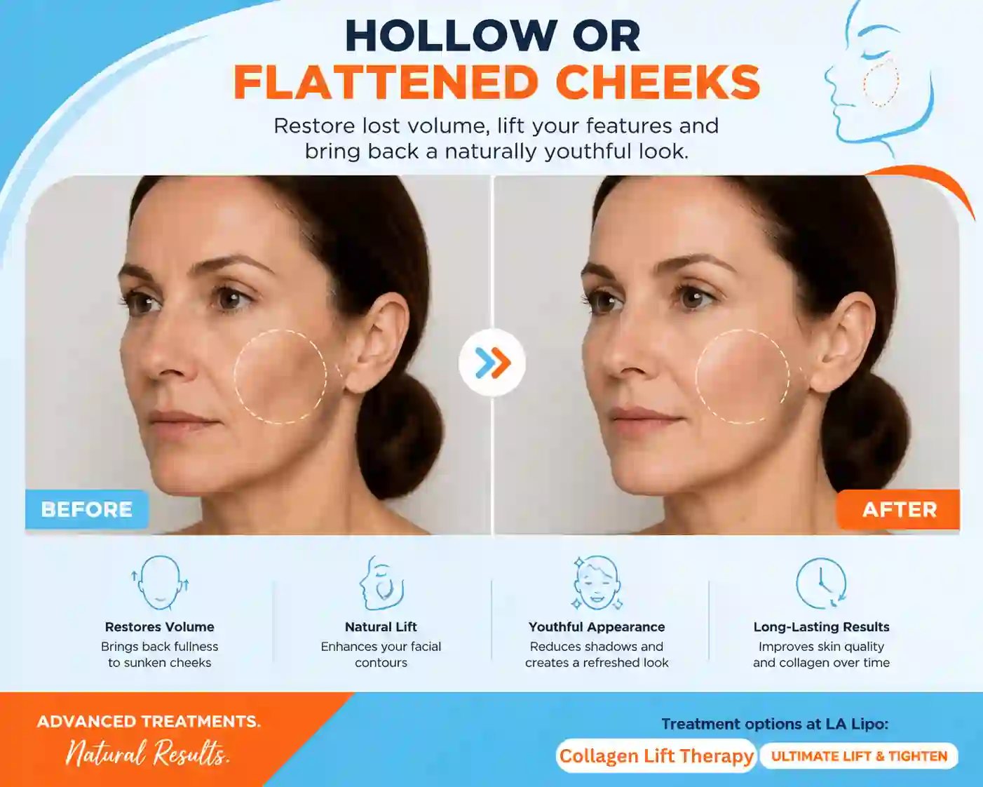 Sign #4: Hollow or Flattened Cheeks Havant
