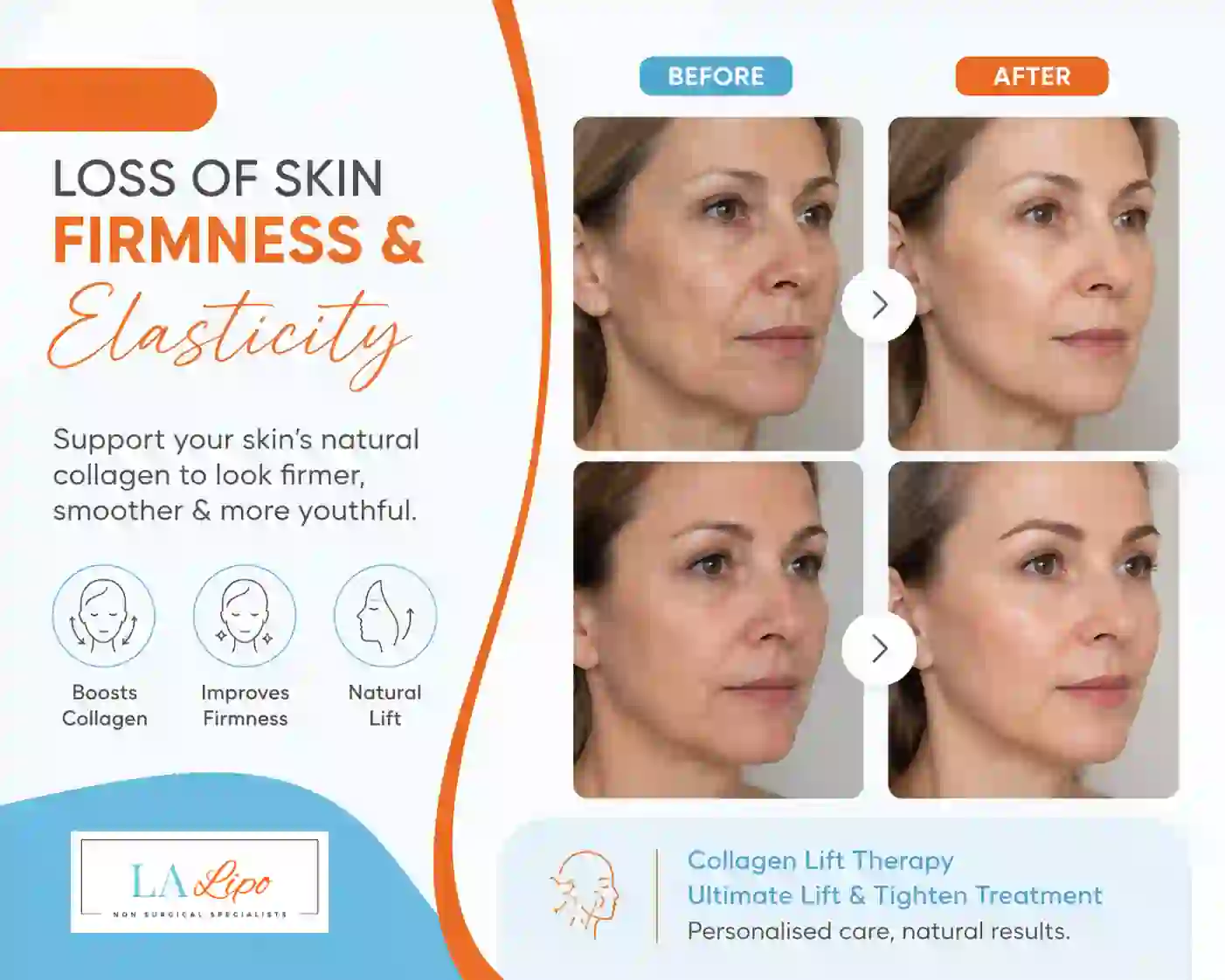 Sign #7: Loss of Skin Firmness and Elasticity Havant